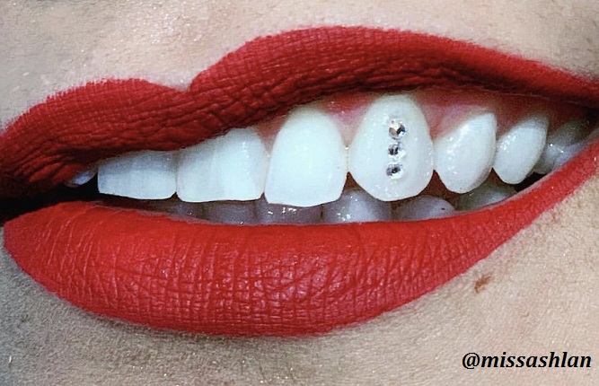 gemstone teeth