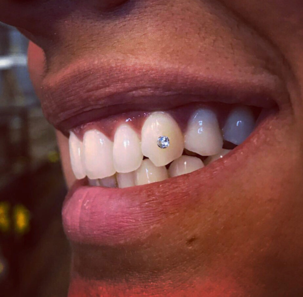 Tooth Gems Swarovski 