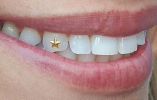 Tooth Gem on side of canine Swarovski crystal Glam up your smile