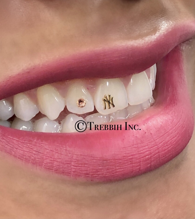Wholesale Tooth Gems, 18K Gold Web