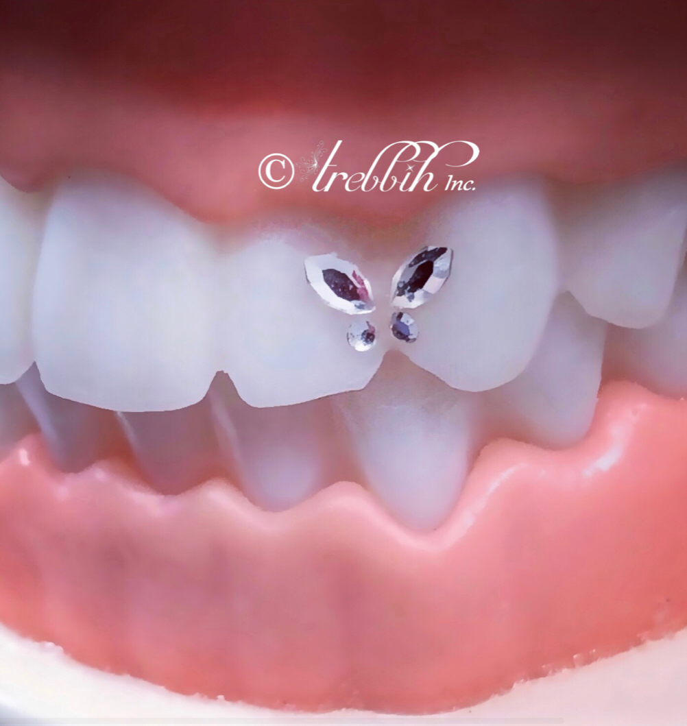 Swarovski Butterfly Tooth Gem Kit – Swarovski Tooth Crystals