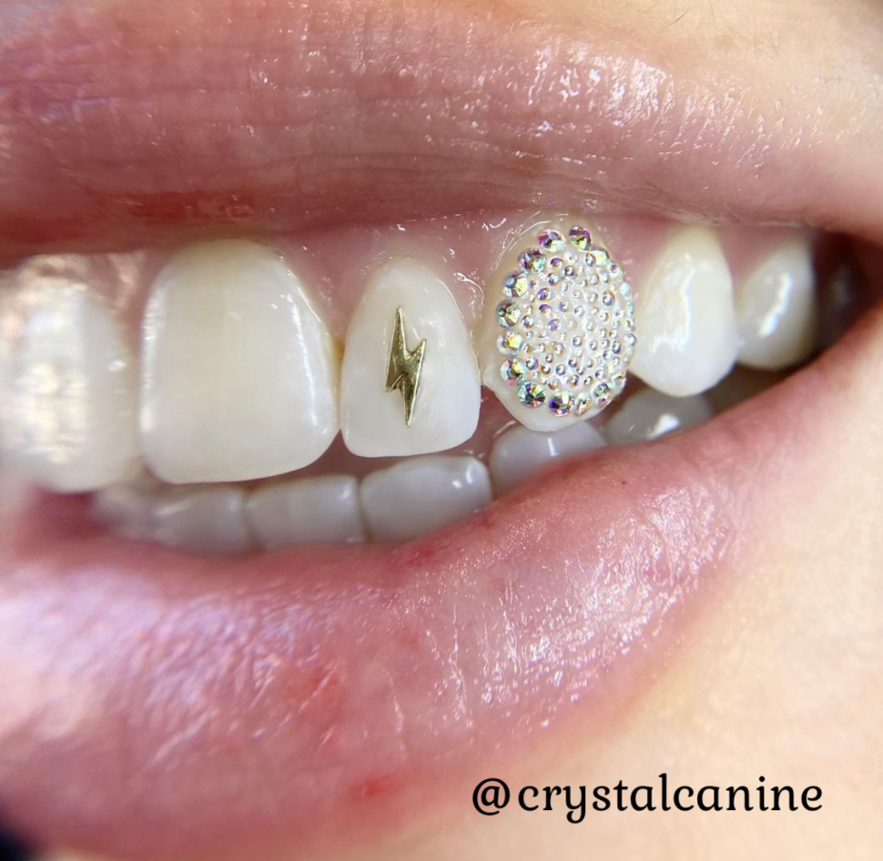 Tooth Gems $45 Swarovski crystal tooth gems add a sparkle to your smile!  $45 for 1, $60 for 2 and $20 for each additio…