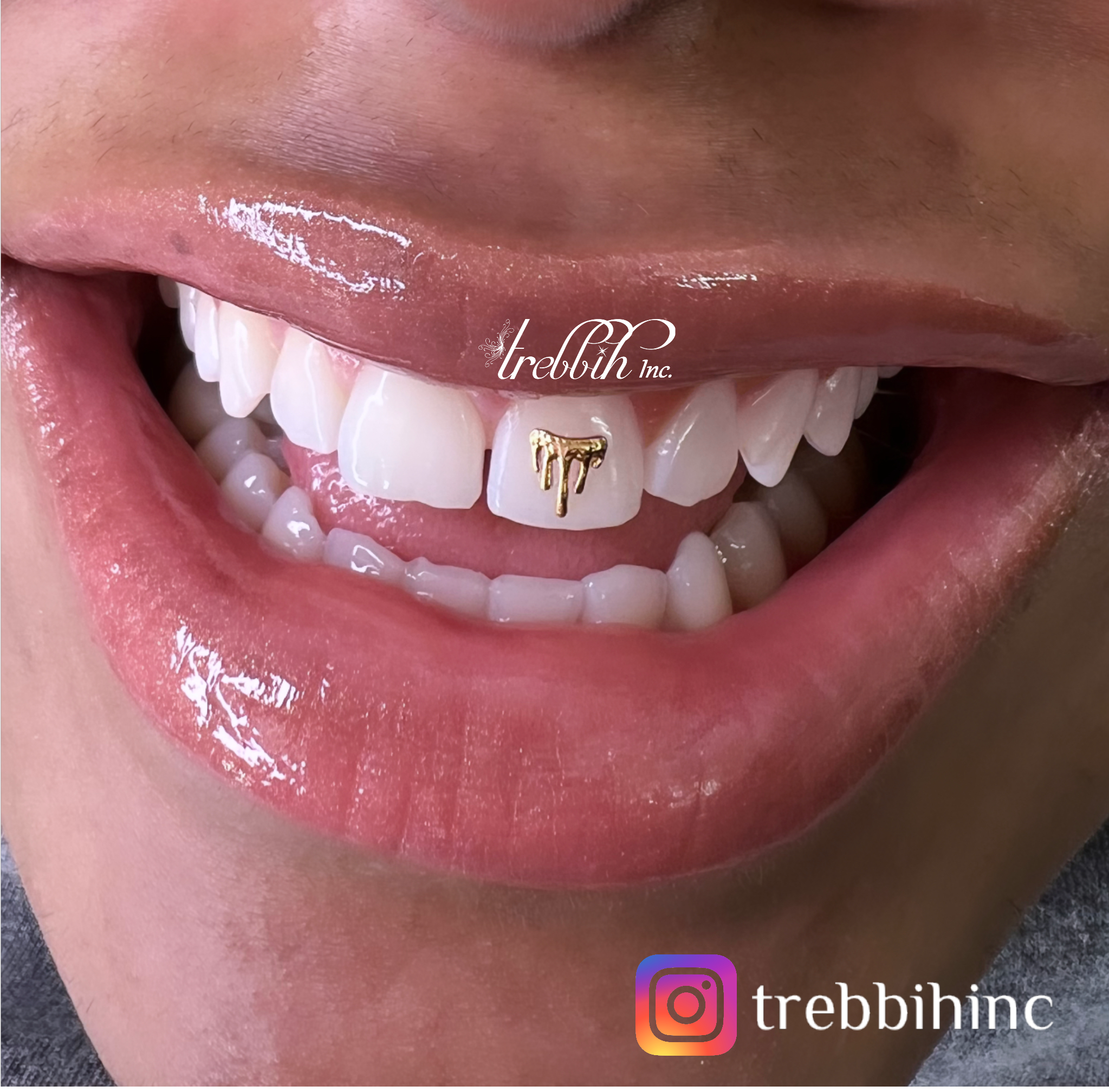 Tooth Gems