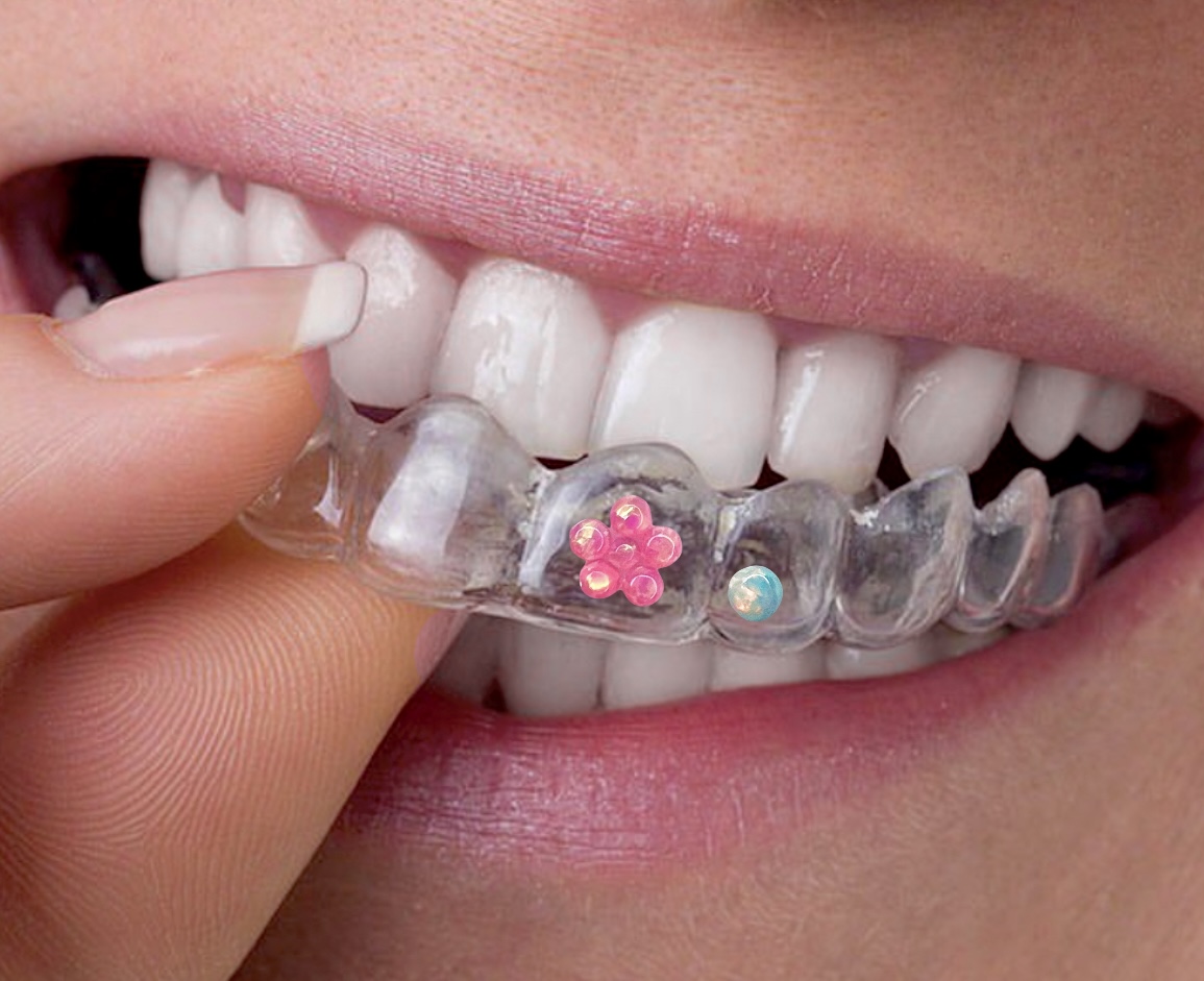Retainer Adhesive for Tooth Gems